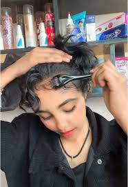 Minoxidil for Hair Growth: Results and Benefits