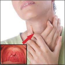 Check spelling or type a new query. Obat Herbal Penyakit Radang Tenggorokan Obat Kanker Paru Paru