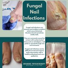 Image result for onychomycosis