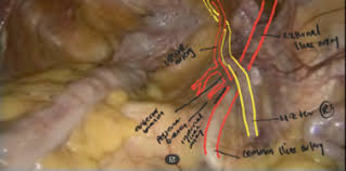 The pelvic girdle and pelvic spine. Laparoscopic Surgical Anatomy For Pelvic Floor Surgery Sciencedirect