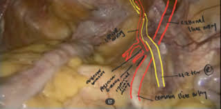 Welcome to the valuemd albums. Laparoscopic Surgical Anatomy For Pelvic Floor Surgery Sciencedirect