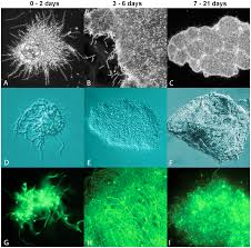 Characterization Of Biofilm Formation By Borrelia Burgdorferi In Vitro