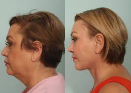 Our office is on the first floor on the vista del sol side of the building. The Medspa Services El Paso Cosmetic Surgery