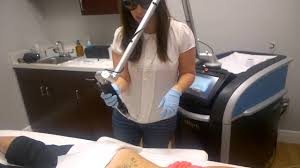 We found 24 results for tattoo removal in or near melbourne, fl. Tattoo Removal W Picosure Melbourne Fl