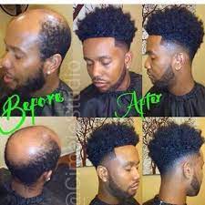Miracle Hair Hair Replacement For Men Man Weave Afro Hair Care
