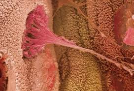 The us food and nutrition board recommends a minimum daily fiber intake of 25 grams for women and 38 grams per day for men, based on research connecting higher fiber. Ulcerative Colitis Diet 19 Foods To Avoid Treatment Causes