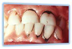 Pin On Dental Health