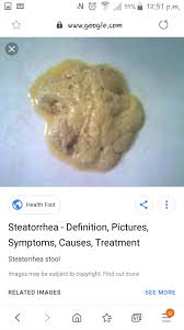 6) your stools are changing. Do I Have Fatty Stools Pics Inside Abdominal Disorders Forums Patient