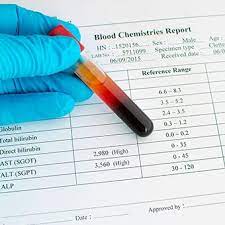 Alanine transaminase (alt) is a transaminase enzyme (ec 2.6.1.2). Liver Function Tests Normal Low And High Ranges Results