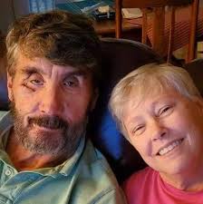 Passing of Grady Green, a Dekalb County Firefighter and Paramedic