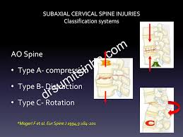 Image result for Subaxial Injury Classification Scale
