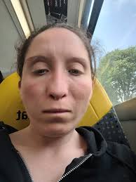 Dear larry, catinets and hoos Yesterday the mother had to go to her  emergency vets she cracked her wisdom tooth