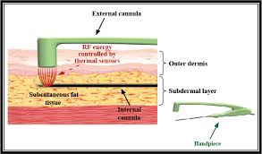 Body fx are championship ballroom dancers so they understand fitness and wellness.the instructors of of jnl fusion (jennifer nicole lee) and figure 8 (jaana kunitz) are not only international fitness and ballrom celebrities; Tv504675 Drsa Block 17 631684s