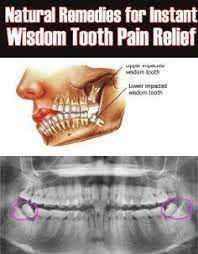 Pin On Dental Implants Full