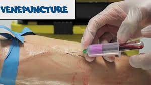 Gather the necessary equipment and tools used to perform the blood draw and place them on a. Venipuncture How To Take Blood Osce Guide Old Version Youtube
