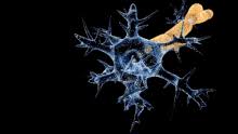 Barre syndrome as a cause of acute flaccid. Guillain Barre Syndrome Wikipedia