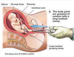 9 kuvaa tai videota kuvat ja videot. Casey Venslauskas On Twitter West On The Verge Of Enormous Metamorphosis X 14 Abortion Constitutes Murder Of An Innocent Human Being Absolutely Not A Pregnant Woman S Trouble But Moral Issue Of Our