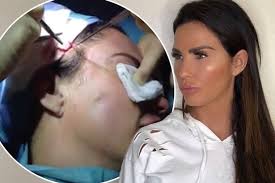 Jun 16, 2021 · katie price defends travelling to turkey for op while country is still on 'red list' the reality star's rep has insisted she's in turkey on a work trip, as she's undergoing an operation that will. Katie Price Says She Looks Like Monster After Surgery And Thought She D Die During Op Mirror Online