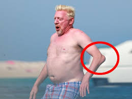 Becker was criticized last week for taking part in a demonstration against. Tennis Boris Becker Elbow Injury Pictured In Yacht Party With Girlfriend Lilian De Carvalho