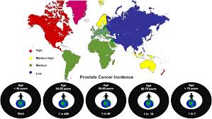Yet it cannot reliably discriminate between benign pathologies and clinically significant forms of pc. Prostate Cancer Diagnostics Clinical Challenges And The Ongoing Need For Disruptive And Effective Diagnostic Tools Sciencedirect