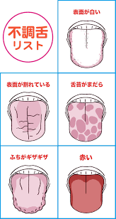 舌には身体のむくみ 乾燥などのサインから 大病の予兆がハッキリ出るという 特に舌の裏は自分の静脈を見られる唯一のところ 舌チェックで今日から病気を遠ざけよう 歯科医師 健康 オーラルケア