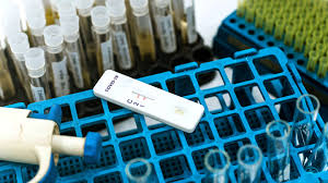 Jakie testy na koronawirusa wykonuje się w laboratorium? Diagnostyka Przeciwcial Anty Sars Cov 2 Testy Elisa Czy Testy Kasetkowe Euroimmun Blog