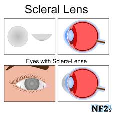 Image result for Sclera