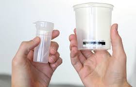 Would-be cheaters bet on synthetic urine | Quest Diagnostics