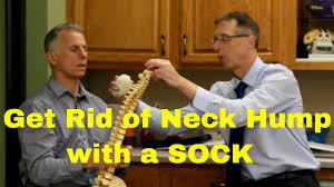 What causes a dowager's hump on the neck? How You Can Get Rid Of Neck Hump With A Sock Dowager S Hump Youtube