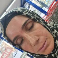 Kızarıklık ve Yanık Kremi Şikayetleri