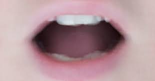 The signs and symptoms of tongue herpes include: What Is Covid Tongue Swollen Sore Tongue May Be Possible Coronavirus Symptom