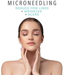 Does micropen help with uneven skin texture : Microneedling Treats Wrinkles Scars Fine Lines Loose Skin More