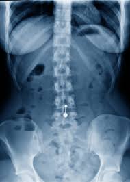 Radiologie Port Marly St Germain Le Vesinet