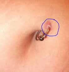 Infected Belly Button Piercing Signs Pictures How To Treat Fix Ring Bump How To Clean Heal Bell In 2021 Belly Button Piercing Infected Belly Button Navel Piercing