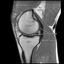 The knee joint is most significantly affected by two major muscle groups: Https Liu Diva Portal Org Smash Get Diva2 1109911 Fulltext01 Pdf
