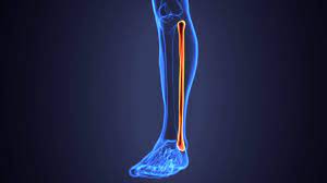 Non Weight Bearing Injury Resource Center Everything You Need To Know