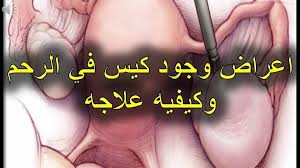 علاج تكيسات المبايض بالحجامة يعرف تكي س 0633013866 0614927722 التداوي بالحجامة بالقنيطرة عند وسيم فيسبوك