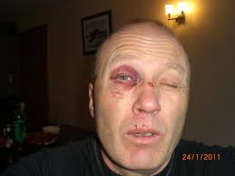 Arne J. Eidal's blogg