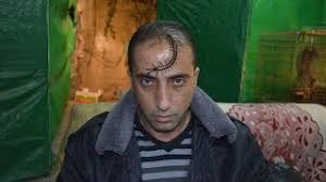 افضل جهاز فحص السكر , ضرورة وجود جهاز السك في كل بيت. Ø§Ù… Ø§Ø±Ø¨Ø¹Ù‡ ÙˆØ§Ø±Ø¨Ø¹ÙŠÙ† 44 ÙˆØ§Ø³Ø±Ø§Ø±Ù‡Ø§ Ù…Ø¹ Ø¬Ù…Ø§Ù„ Ø§Ù„Ø¹Ù…ÙˆØ§Ø³ÙŠ Youtube