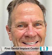 First Dental Implant Center