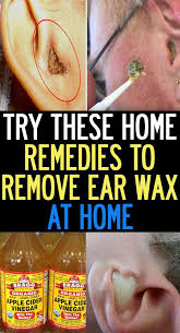 Cleaning Hacks Hacks Are Readily Available On Our Web Pages Take A Look And You Will Not Be Sorry Yo In 2020 Natural Ear Infection Remedy Ear Wax Ear Infection Remedy