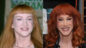 How Kathy Griffin's Face Has Transformed Over The Years, According To Our  Plastic Surgeon