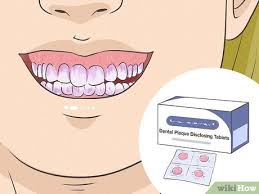 How to remove braces from home?. 3 Ways To Remove Plaque Wikihow