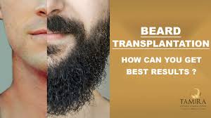 External method for removing facial hair naturally. Moustache Beard Transplant In Chennai At Tamira Plastic Surgery