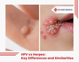 Image result for human papillomavirus symptoms