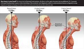 Pain of the rhomboid muscle is the pain, which is present in the upper back region just beneath the neck and between the upper shoulder blades. Symptoms And Treatments Of Spinal Curvature Problems Caring Medical Florida