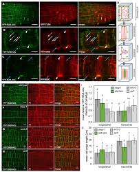 The tissue that is responsible for a plant's unceasing growth is the meristematic tissue. Two Mechanisms Regulate Directional Cell Growth In Arabidopsis Lateral Roots Elife
