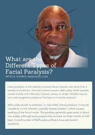 Maybe you would like to learn more about one of these? Facial Paralysis