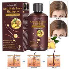 Art naturals hair growth treatment argan oil shampoo blends dht blockers with proteins, botanical oils and extracts to prevent hair damage and further hair loss. Amazon Com Hair Growth Shampoo Hair Loss Shampoo Hair Thickening Shampoo Helps Stop Hair Loss Grow Hair Fast Hair Loss Treatment For Men Women 220ml Beauty