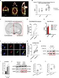 See more of muzik muzik 31 on facebook. The Translocator Protein Tspo Is Prodromal To Mitophagy Loss In Neurotoxicity Molecular Psychiatry